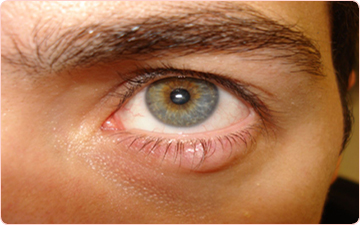 Eye Treatment at Integral Universe Wellness Clinic