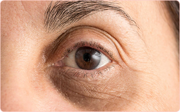 Eye Treatment in Brampton at Integral Universe Wellness Clinic